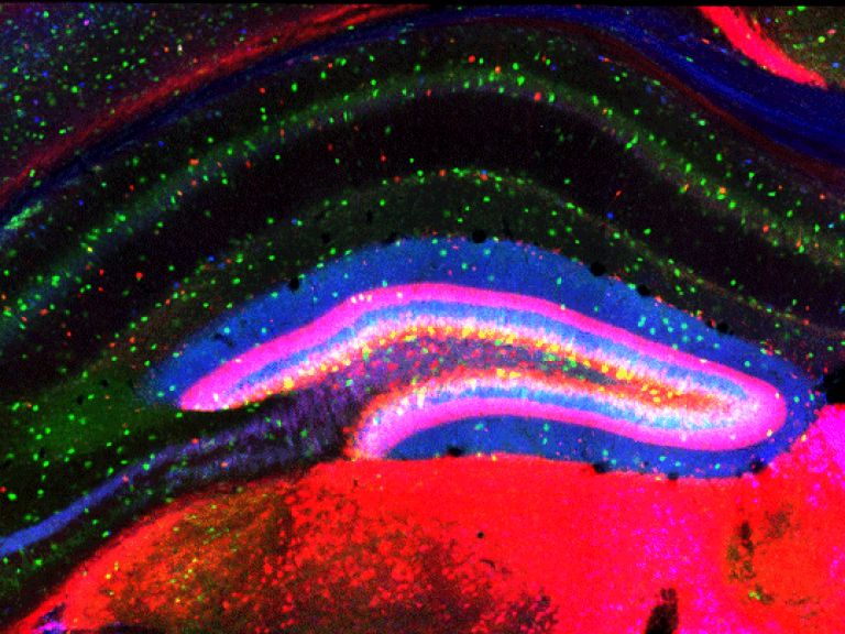 Interneurons of the mouse hippocampus (green cells) come in different flavors as illustrated by their expression of calretinin (Red) or calbindin (blue). © C Heinrich/O. Raineteau - SBRI